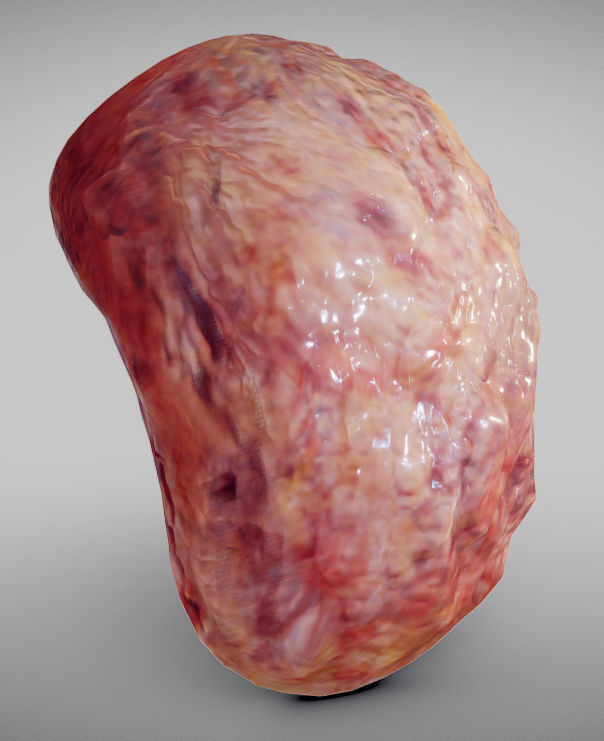 Fatty Liver Low-poly 3D model_16