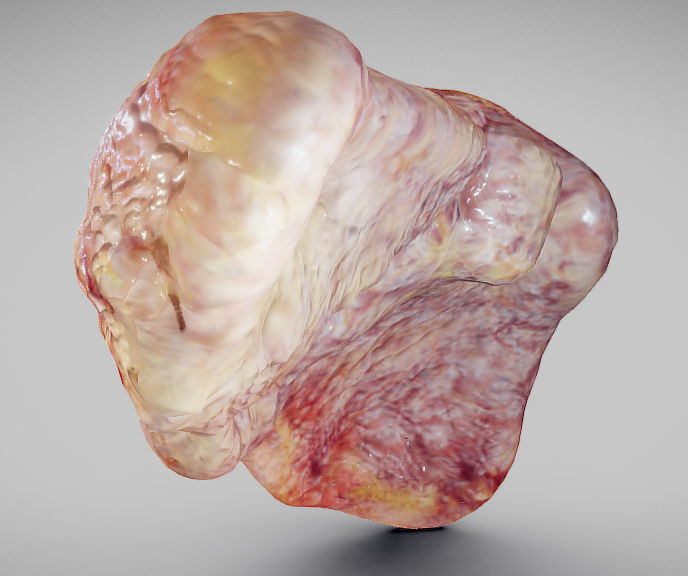 Fatty Liver Low-poly 3D model_13