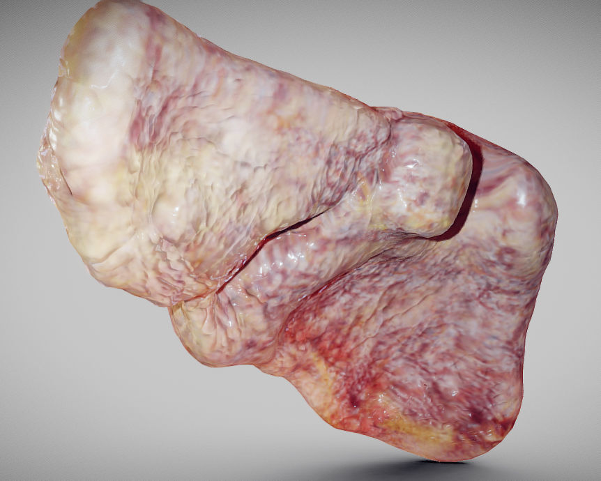 Fatty Liver Low-poly 3D model_14