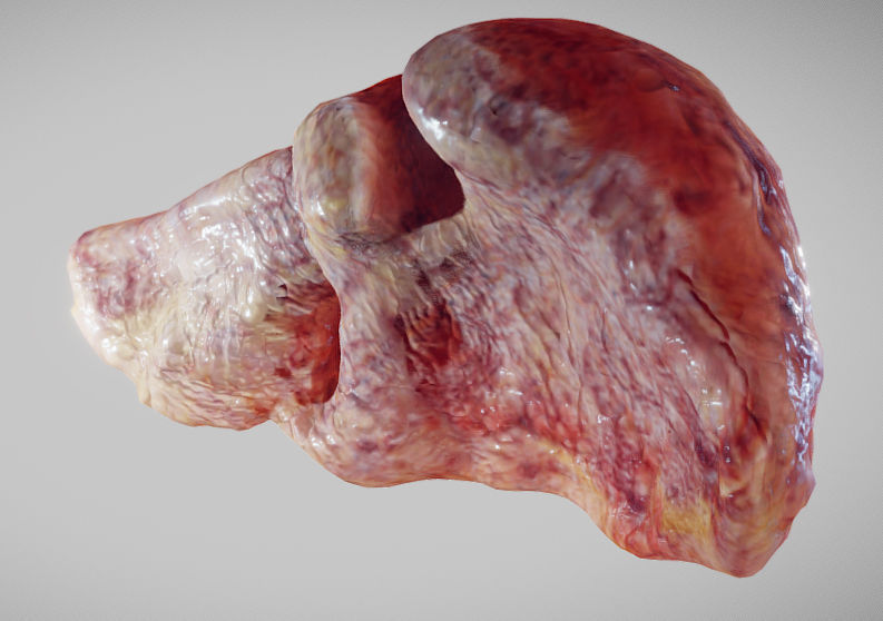 Fatty Liver Low-poly 3D model_15