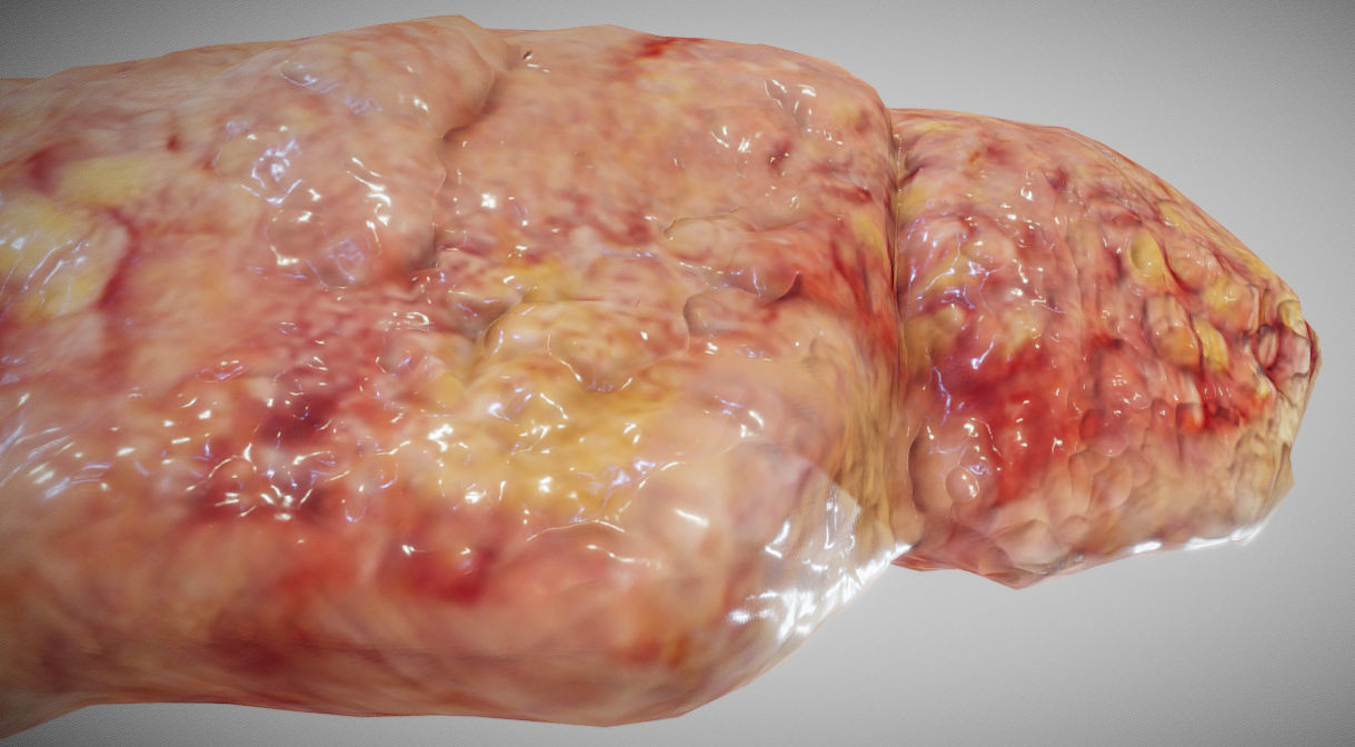 Fatty Liver Low-poly 3D model_6