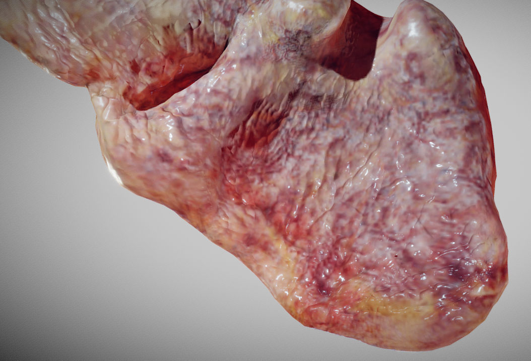 Fatty Liver Low-poly 3D model_8