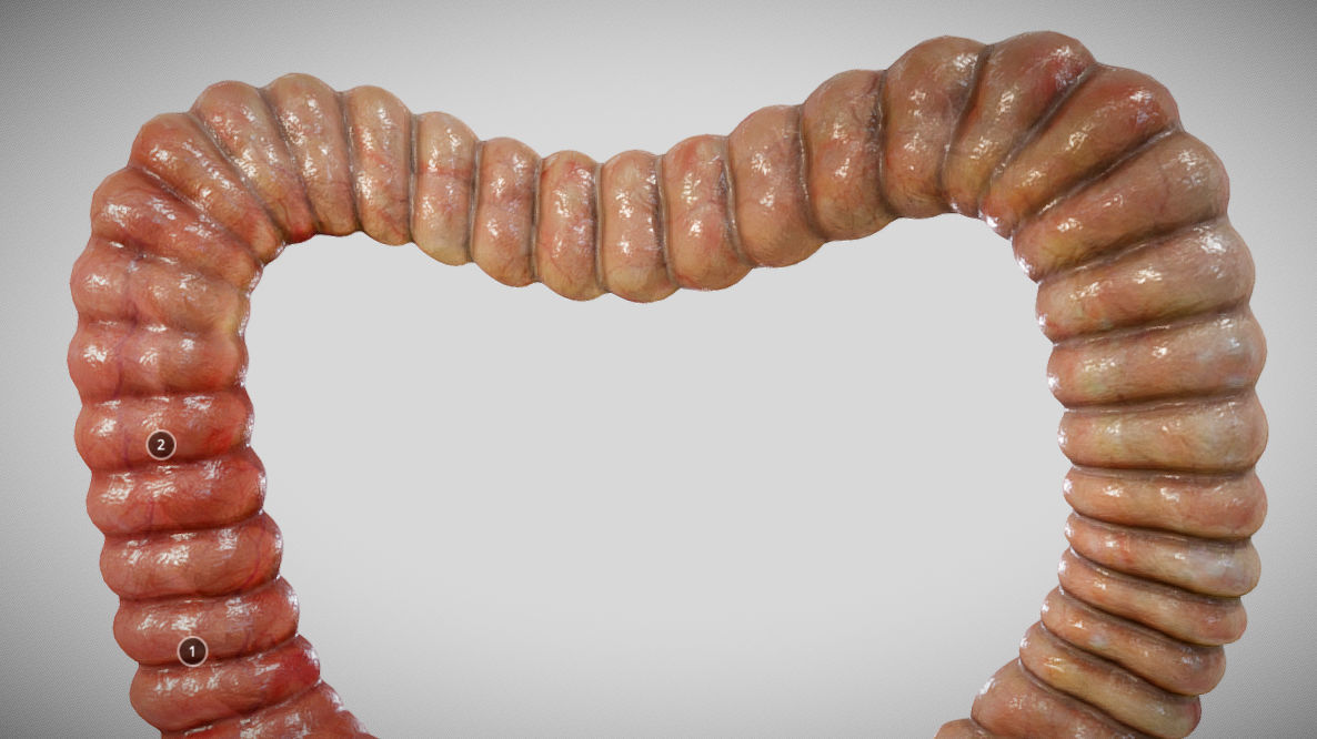 Ulcerative Colitis Low-poly 3D model_16