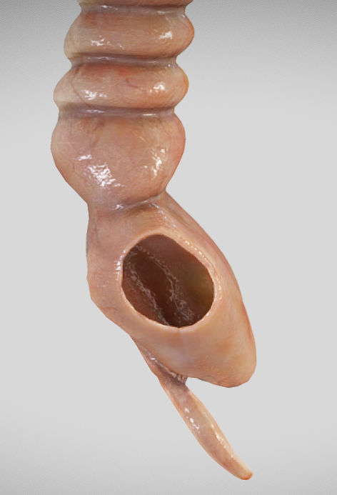 Ulcerative Colitis Low-poly 3D model_13