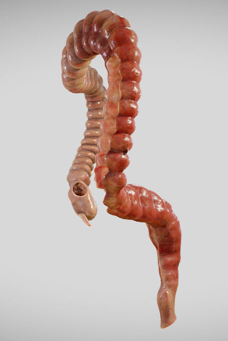 Ulcerative Colitis Low-poly 3D model_24
