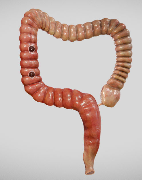 Ulcerative Colitis Low-poly 3D model_27