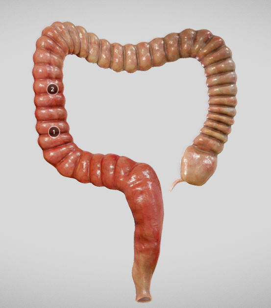 Ulcerative Colitis Low-poly 3D model_28