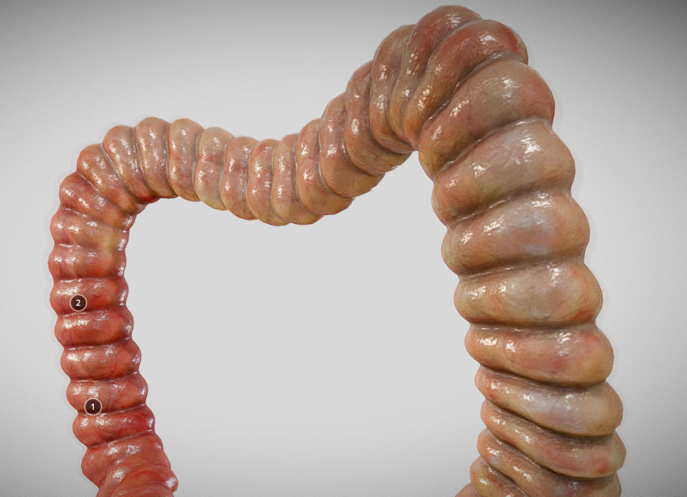 Ulcerative Colitis Low-poly 3D model_17