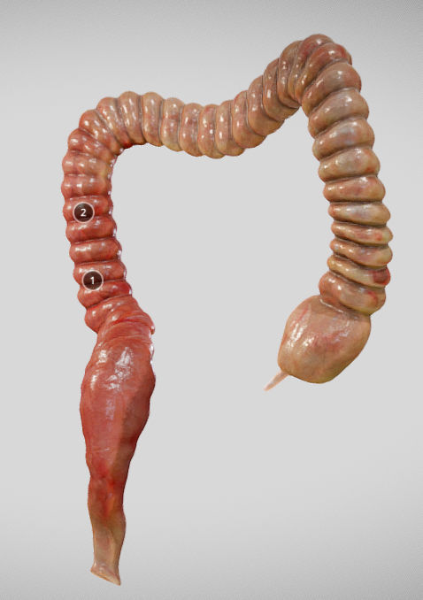 Ulcerative Colitis Low-poly 3D model_1