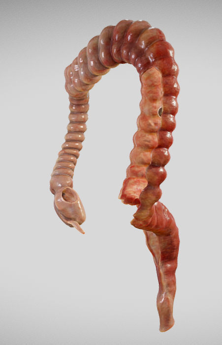 Ulcerative Colitis Low-poly 3D model_22