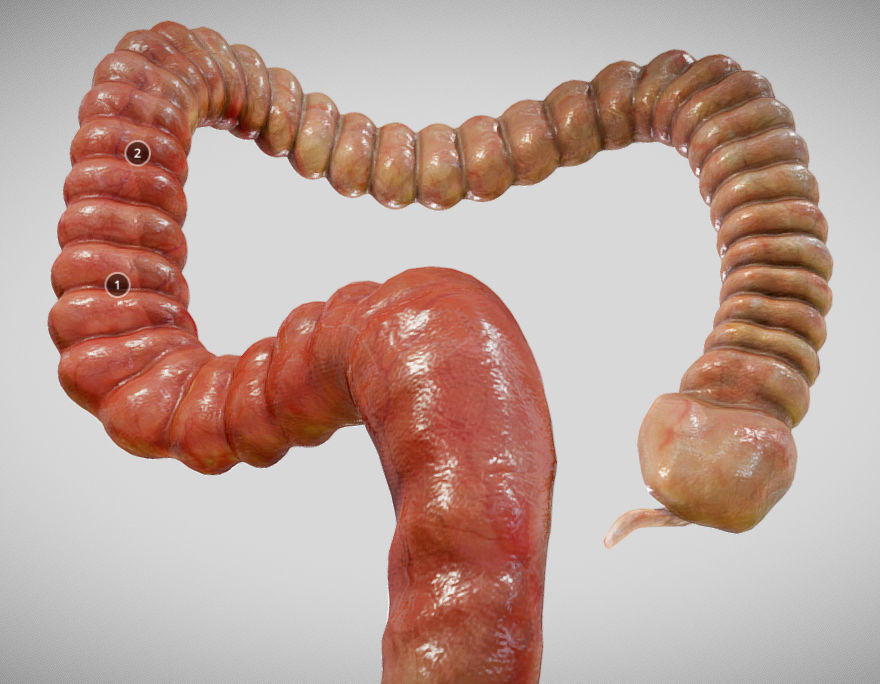 Ulcerative Colitis Low-poly 3D model_15