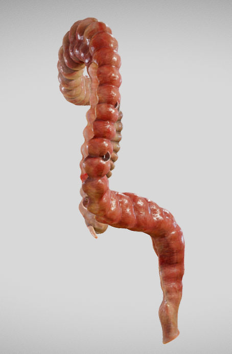 Ulcerative Colitis Low-poly 3D model_25