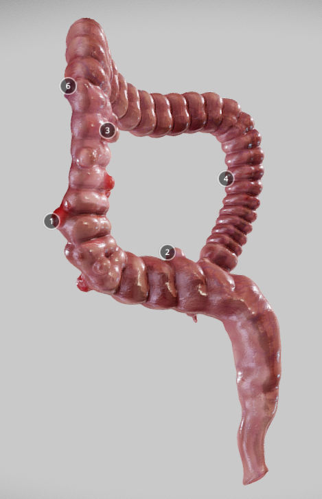 Diverticulosis and Diverticulitis Low-poly 3D model_33