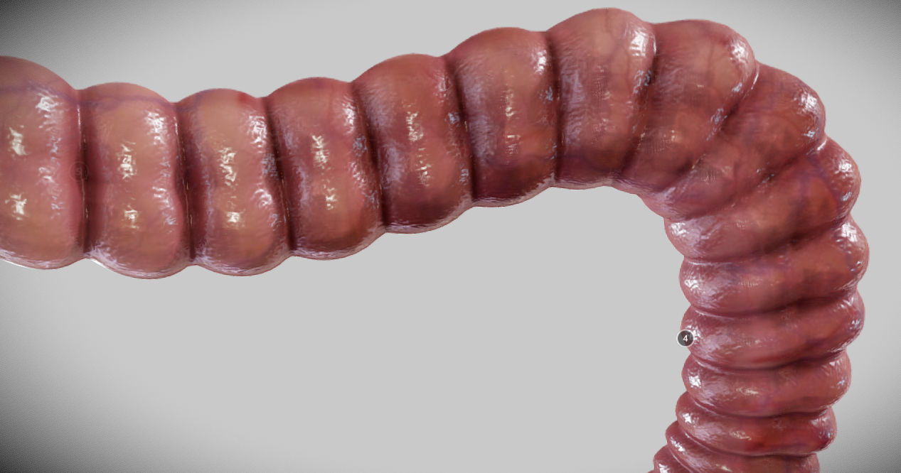 Diverticulosis and Diverticulitis Low-poly 3D model_21