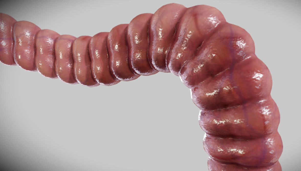 Diverticulosis and Diverticulitis Low-poly 3D model_23