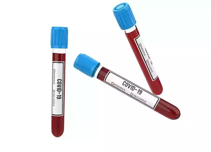 Covid-19 test tube 3D print model
