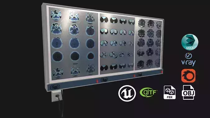 screen x ray film viewer Game ready