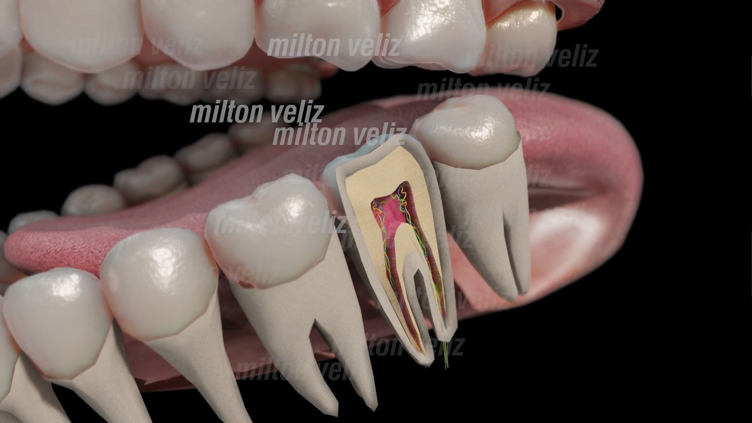 Teeth Denture Upper and lower Jaw with gums and tongue Low-poly 3D model_2