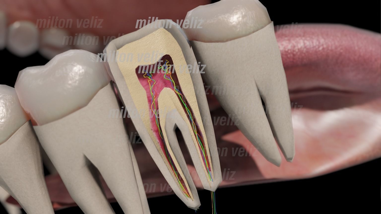 Teeth Denture Upper and lower Jaw with gums and tongue Low-poly 3D model_3