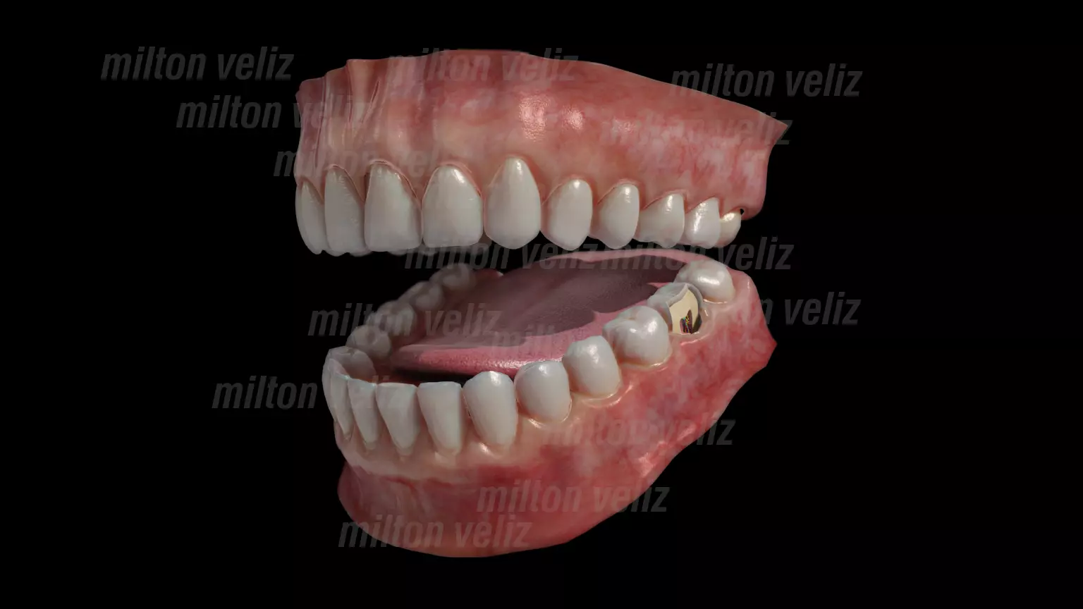 Teeth Denture Upper and lower Jaw with gums and tongue Low-poly 3D model_0