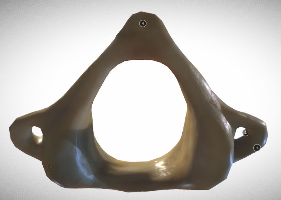Human atlas C1 vertebra Low-poly 3D model_5