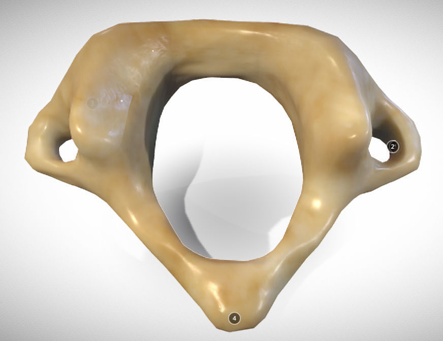 Human atlas C1 vertebra Low-poly 3D model_4