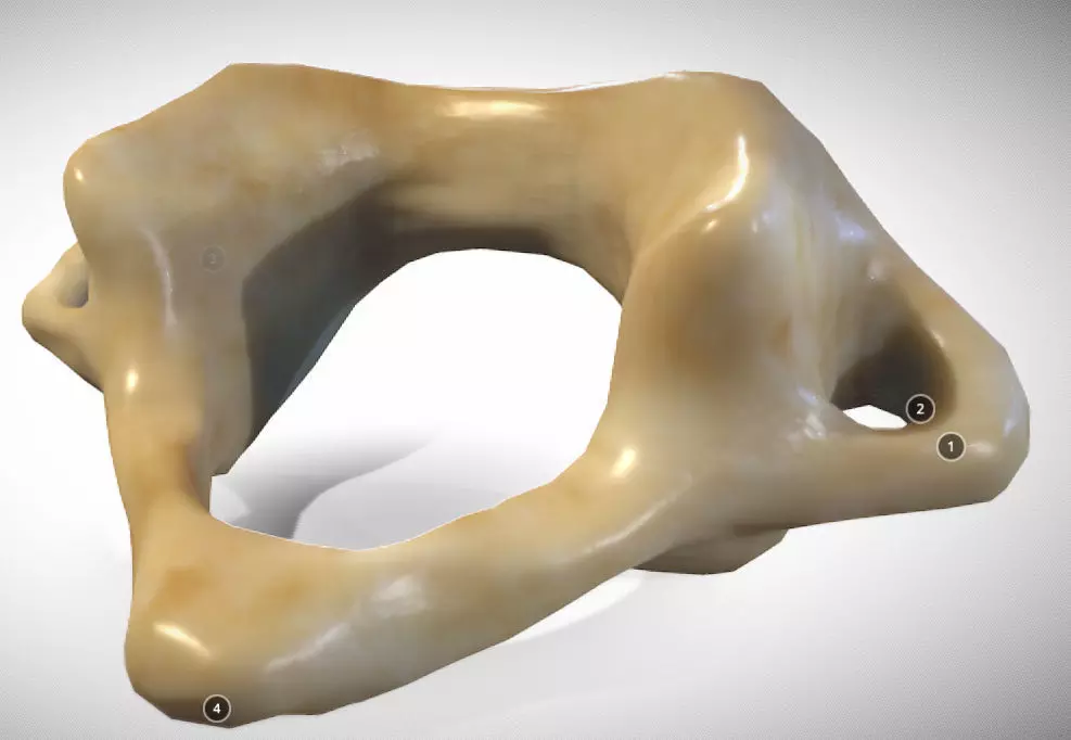 Human atlas C1 vertebra Low-poly 3D model_0