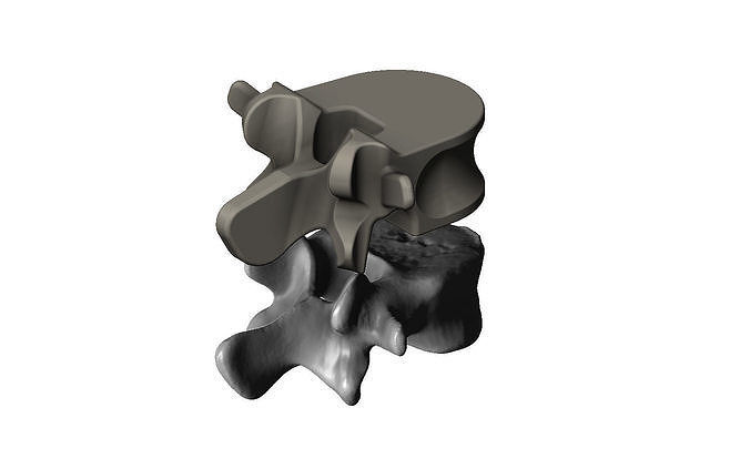 Spinal vertebrae 3D print model