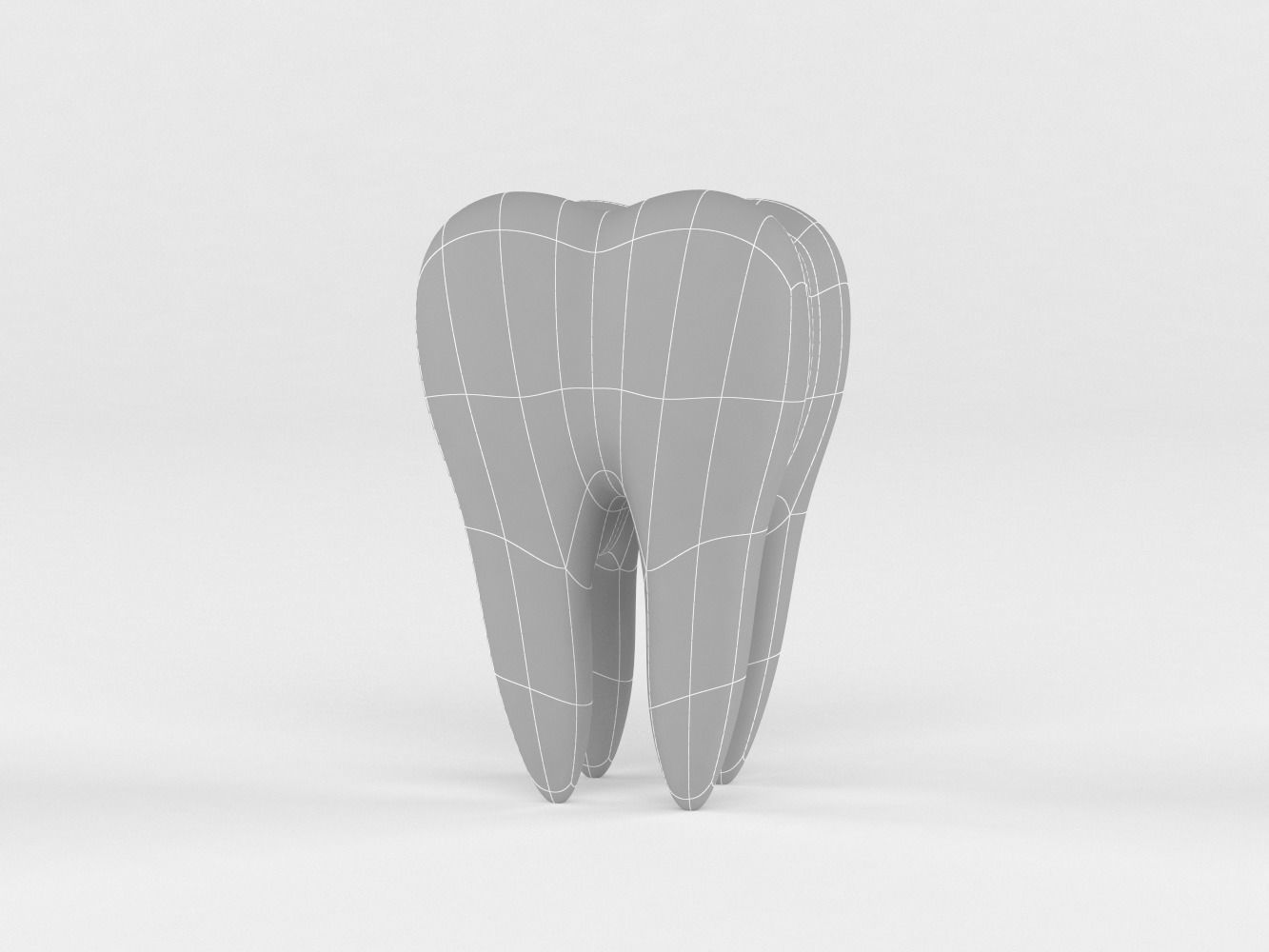 Tooth Implants 3D model_9