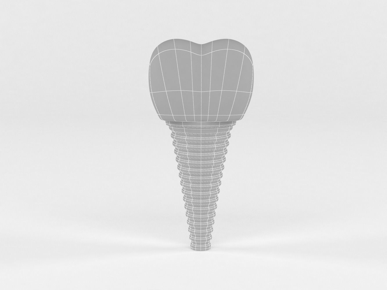 Tooth Implants 3D model_8