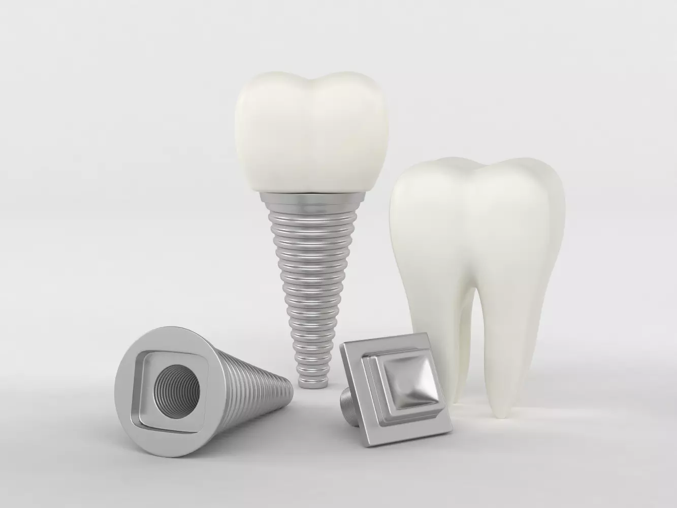 Tooth Implants 3D model_0