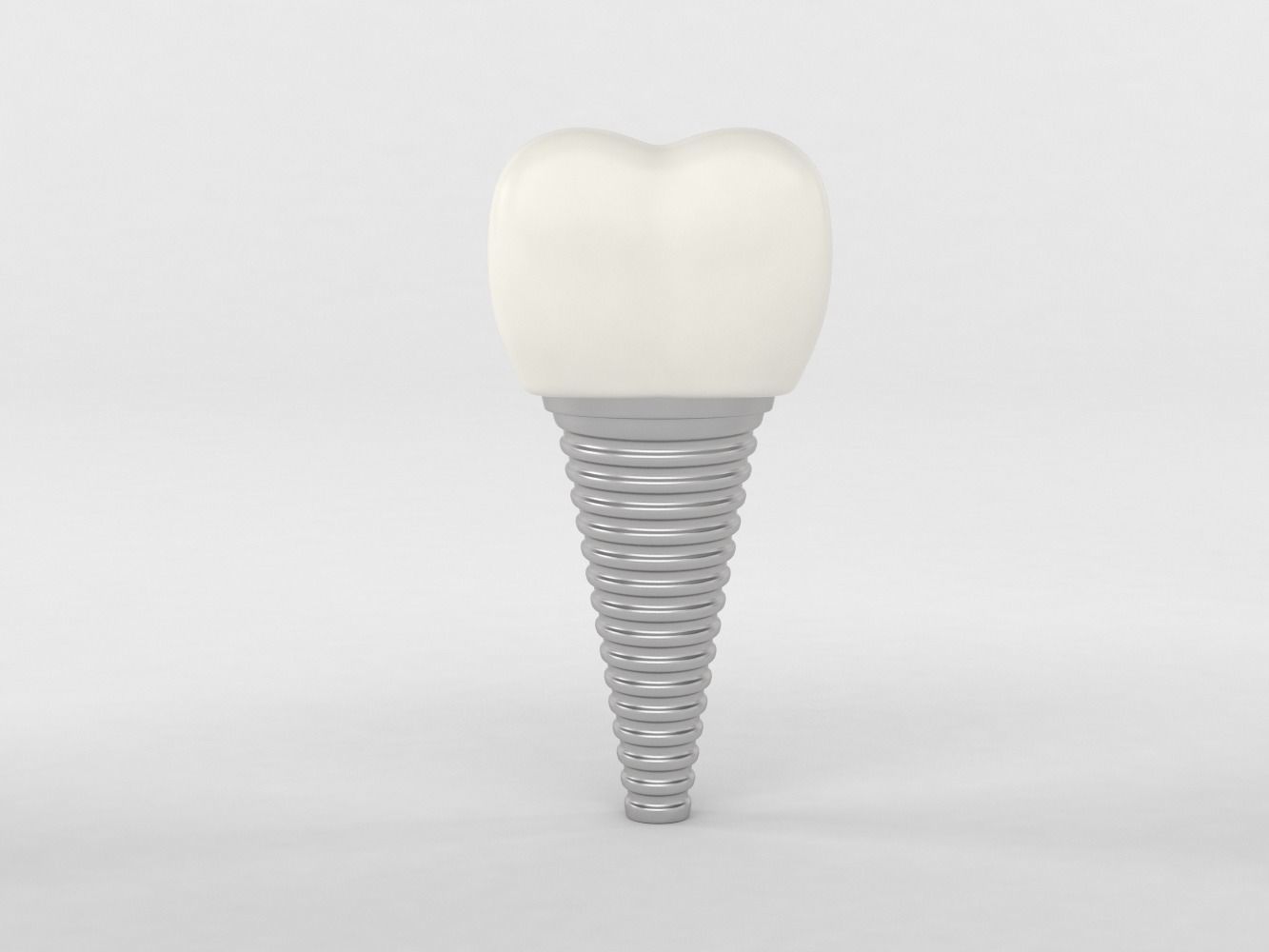 Tooth Implants 3D model_3