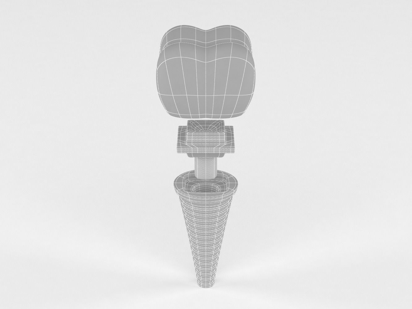 Tooth Implants 3D model_6
