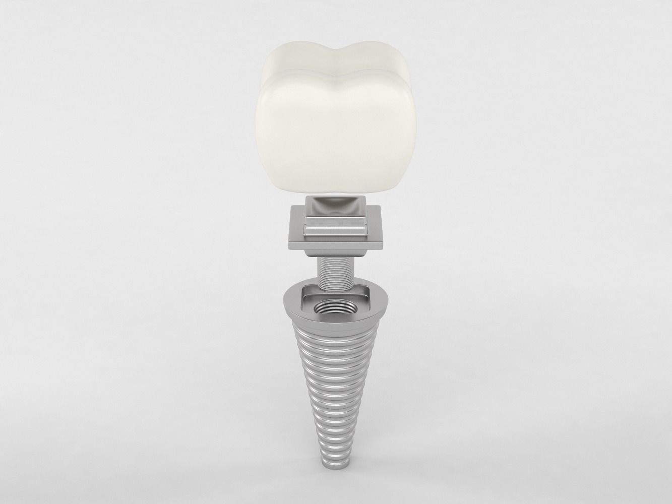 Tooth Implants 3D model_1