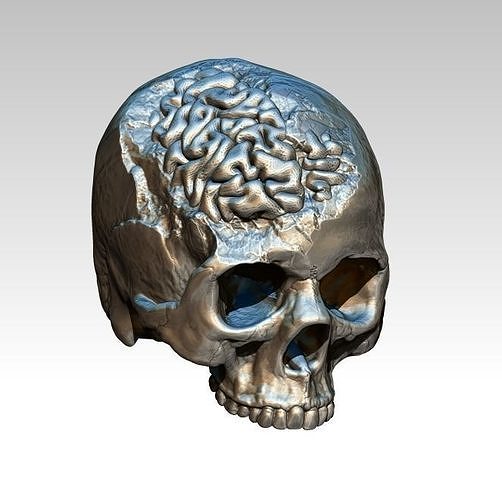 Human Brain Skull Damage Salvage Highpoly Detailed Realistic 3D print model