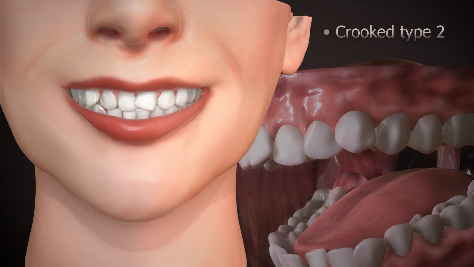 Great Teeth Collection - Mouth for character Low-poly 3D model_10