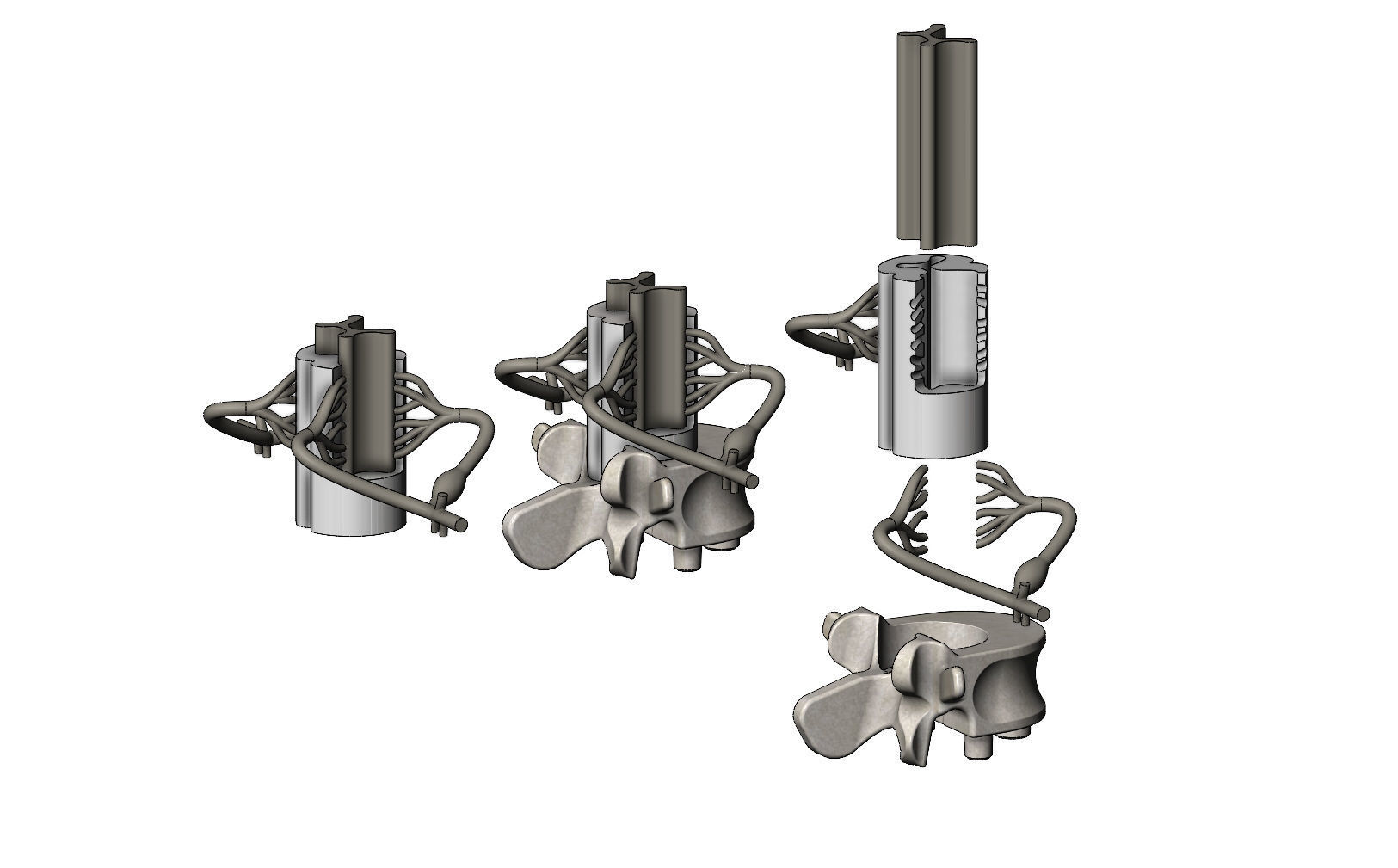 Simplified spinal cord cross section 3D print model_1