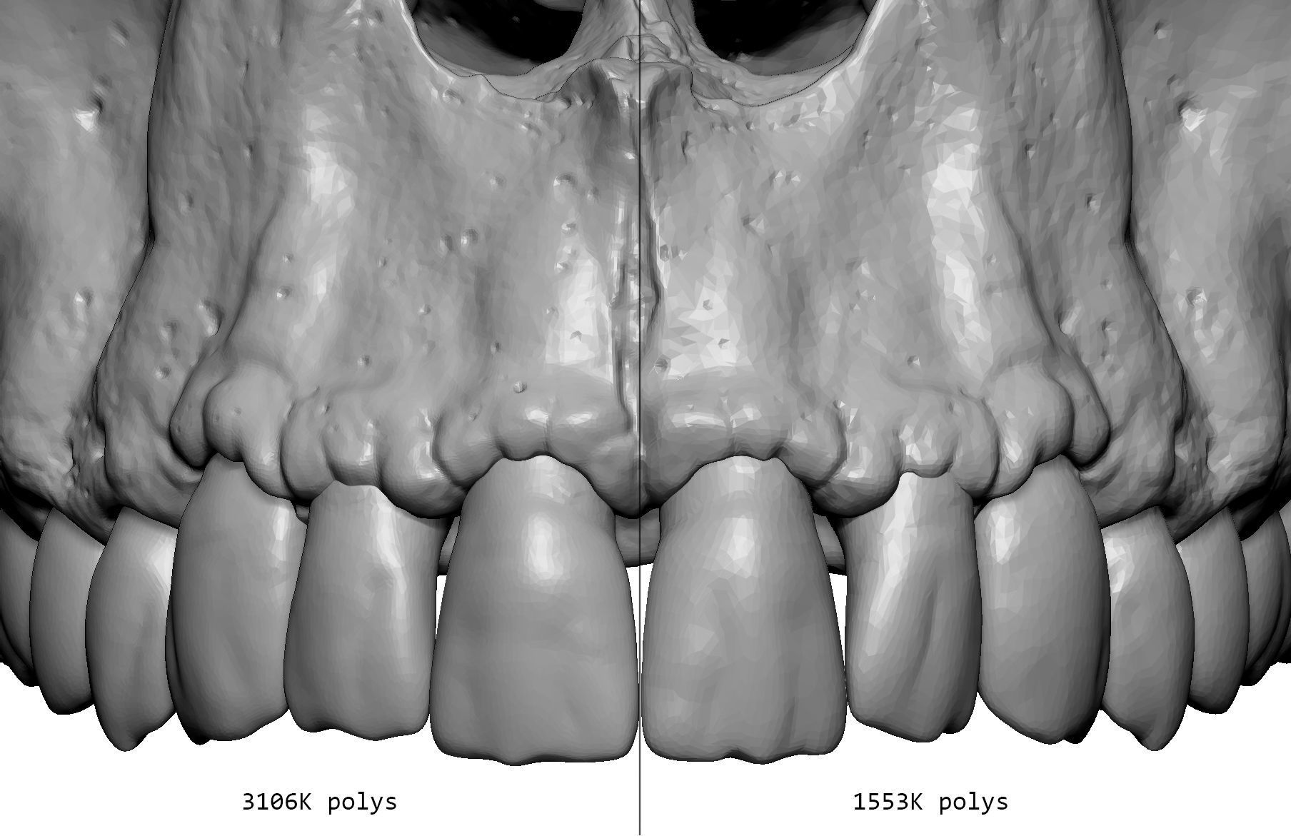 Female human skull- realistic 3d print model- 3 versions set 3D print model_22