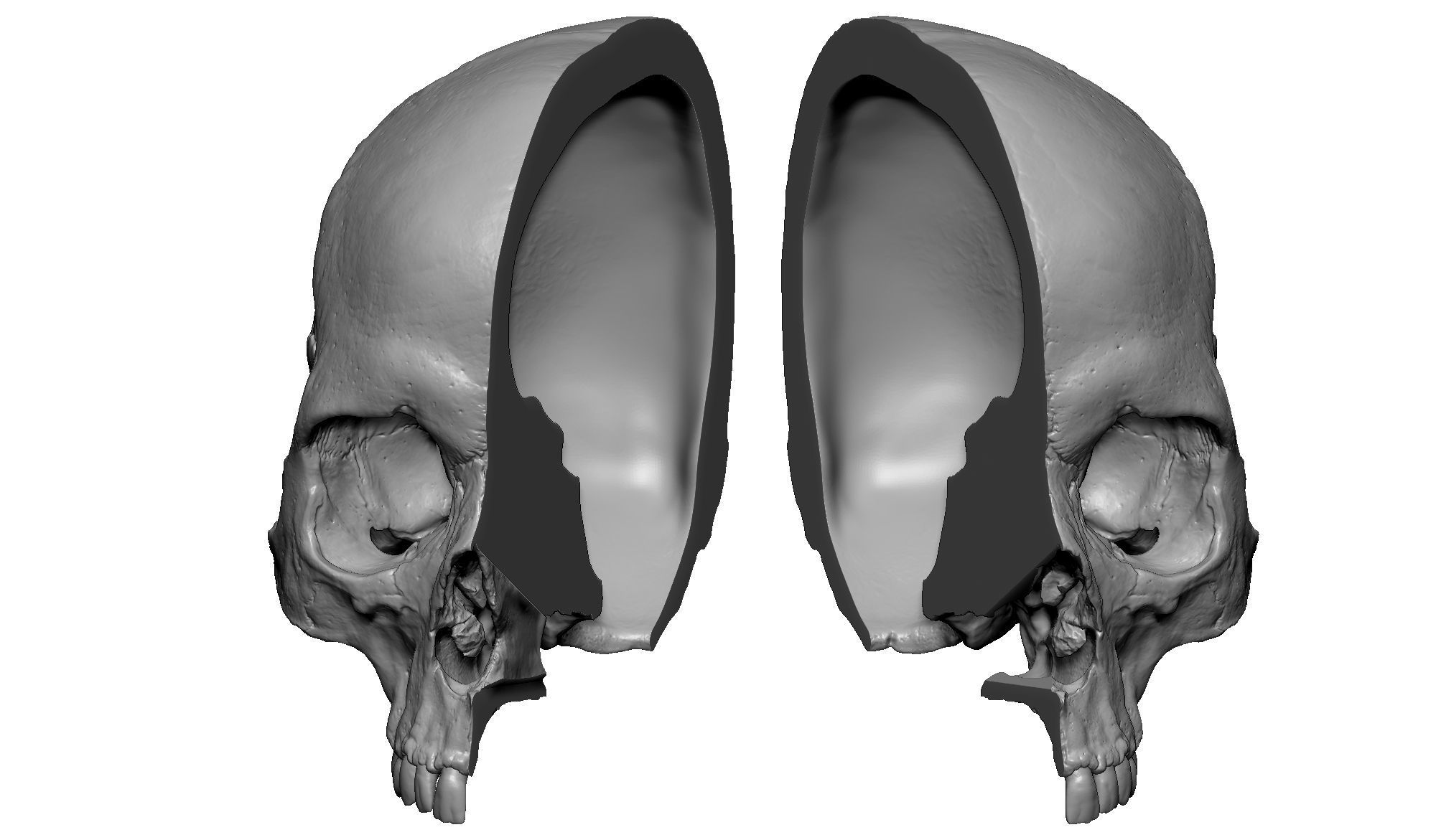 Female human skull- realistic 3d print model- 3 versions set 3D print model_13