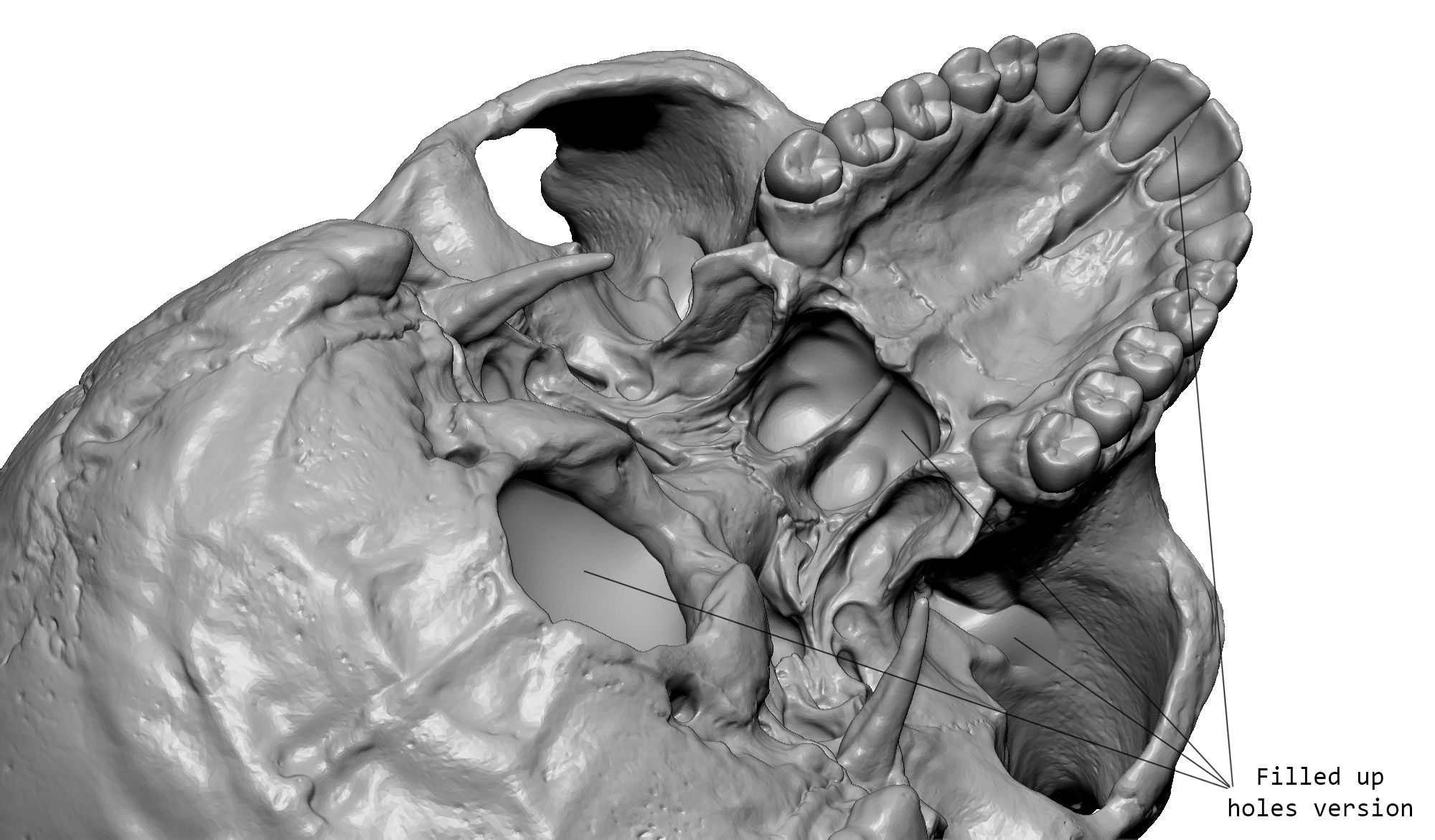 Female human skull- realistic 3d print model- 3 versions set 3D print model_21