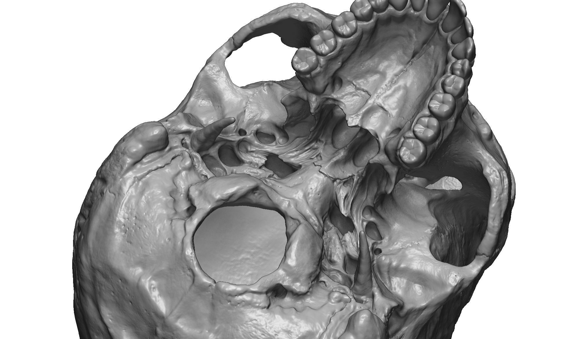 Female human skull- realistic 3d print model- 3 versions set 3D print model_20
