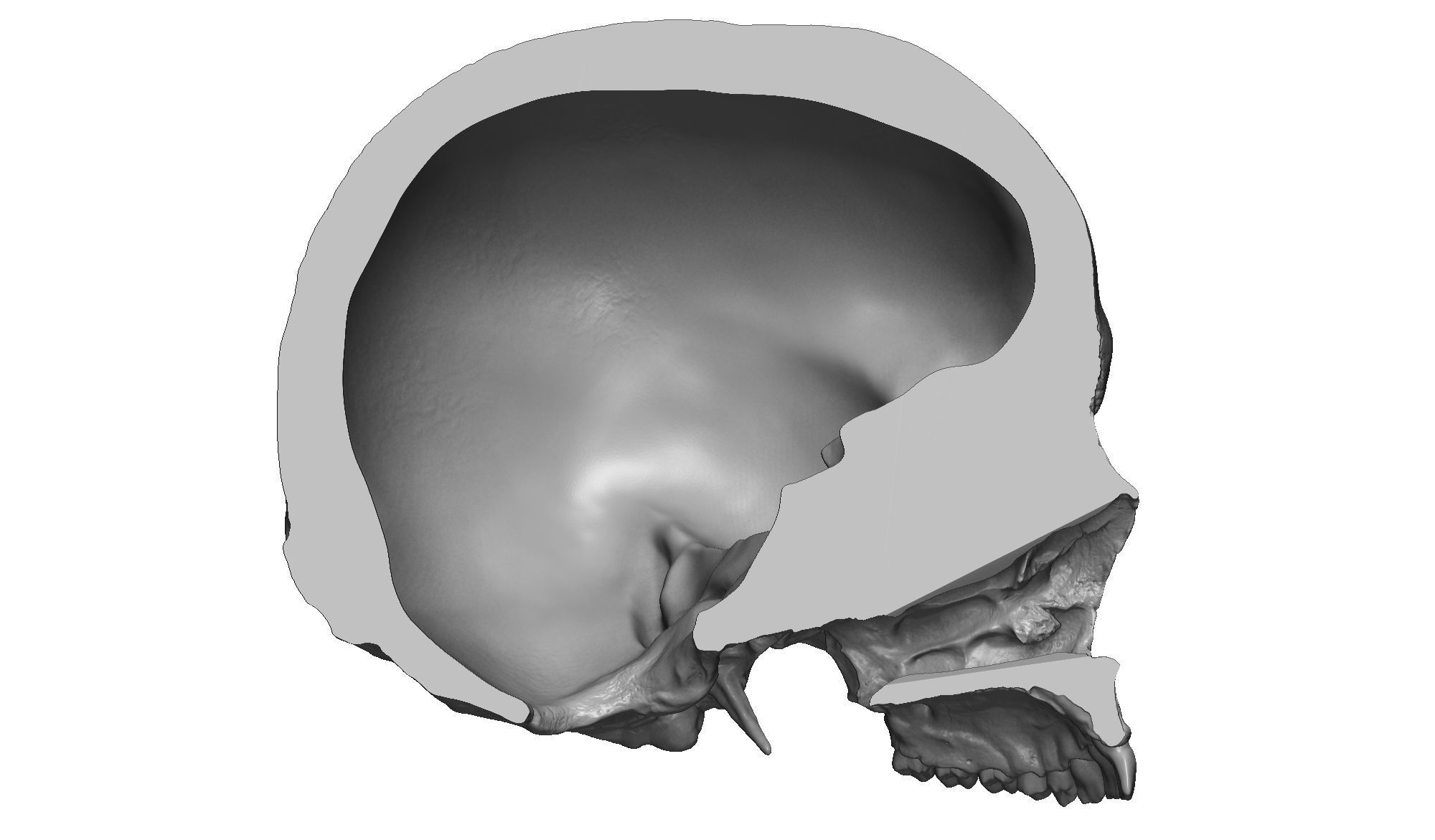 Female human skull- realistic 3d print model- 3 versions set 3D print model_14
