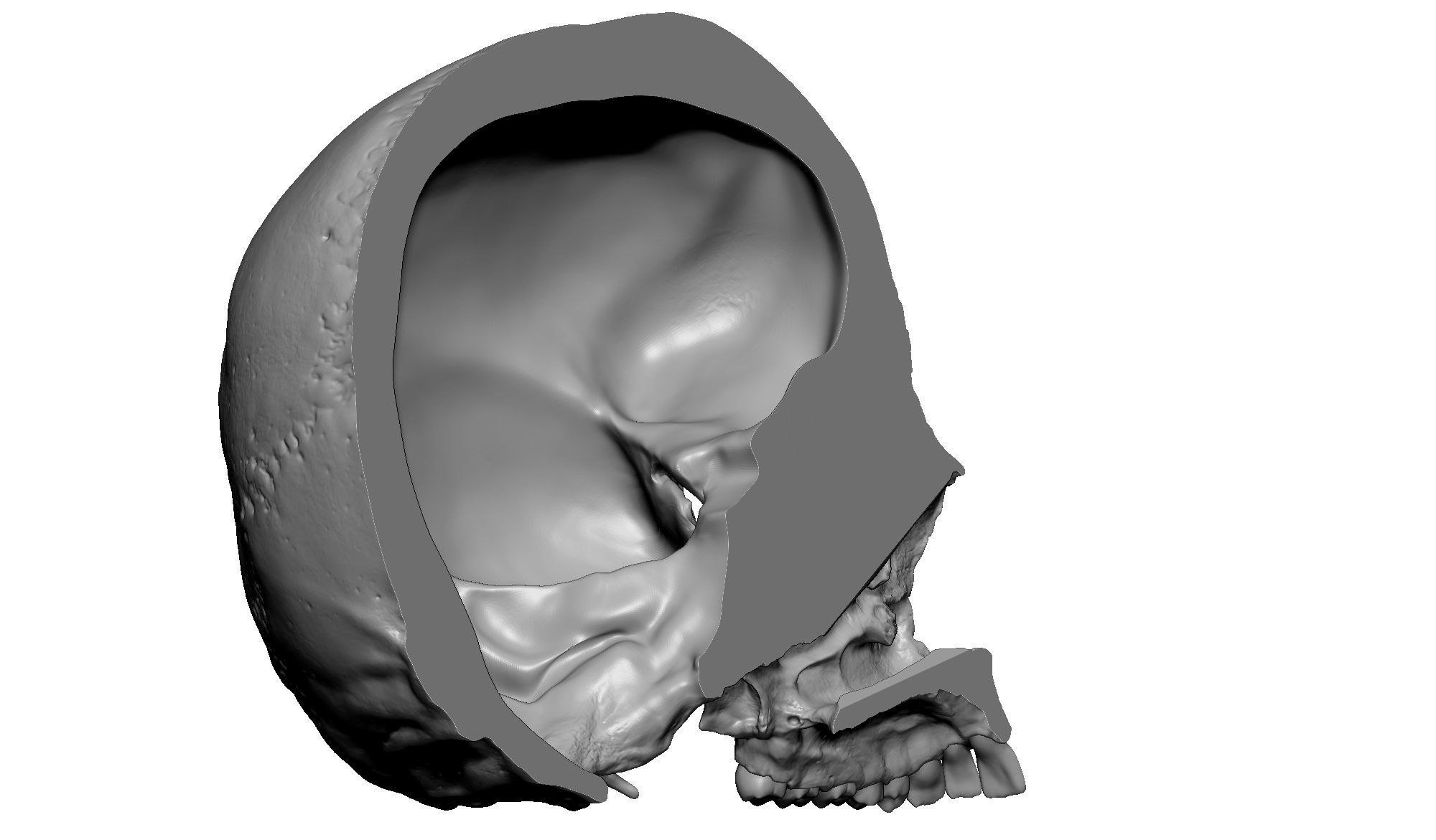 Female human skull- realistic 3d print model- 3 versions set 3D print model_15