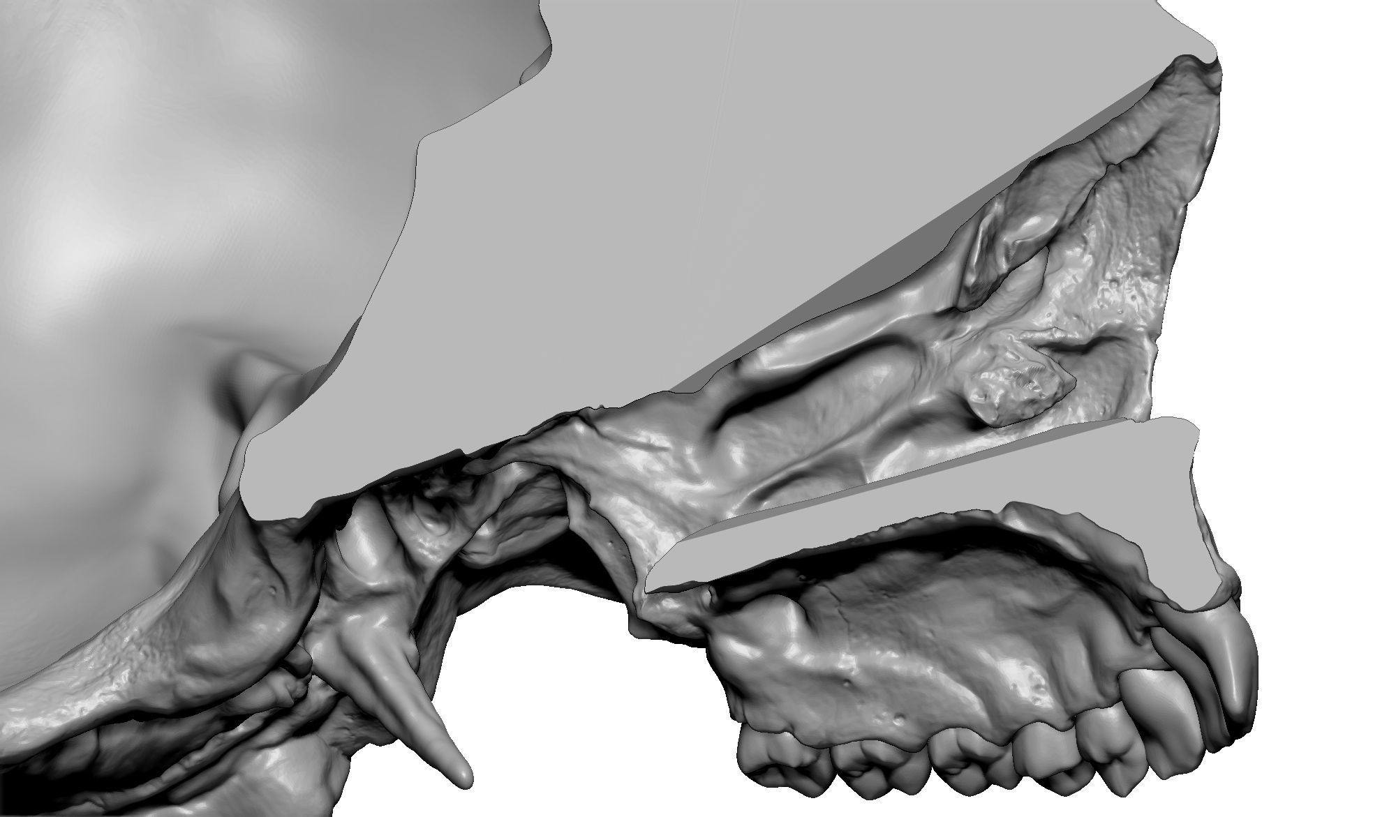 Female human skull- realistic 3d print model- 3 versions set 3D print model_16