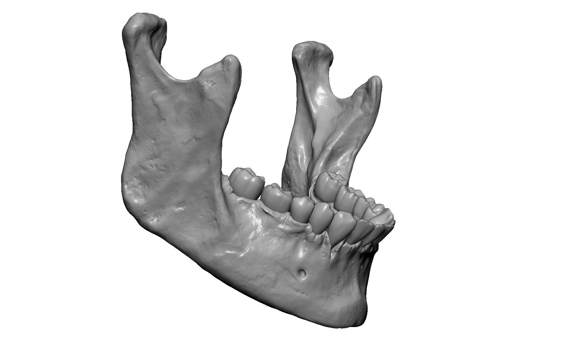 Female human skull- realistic 3d print model- 3 versions set 3D print model_23