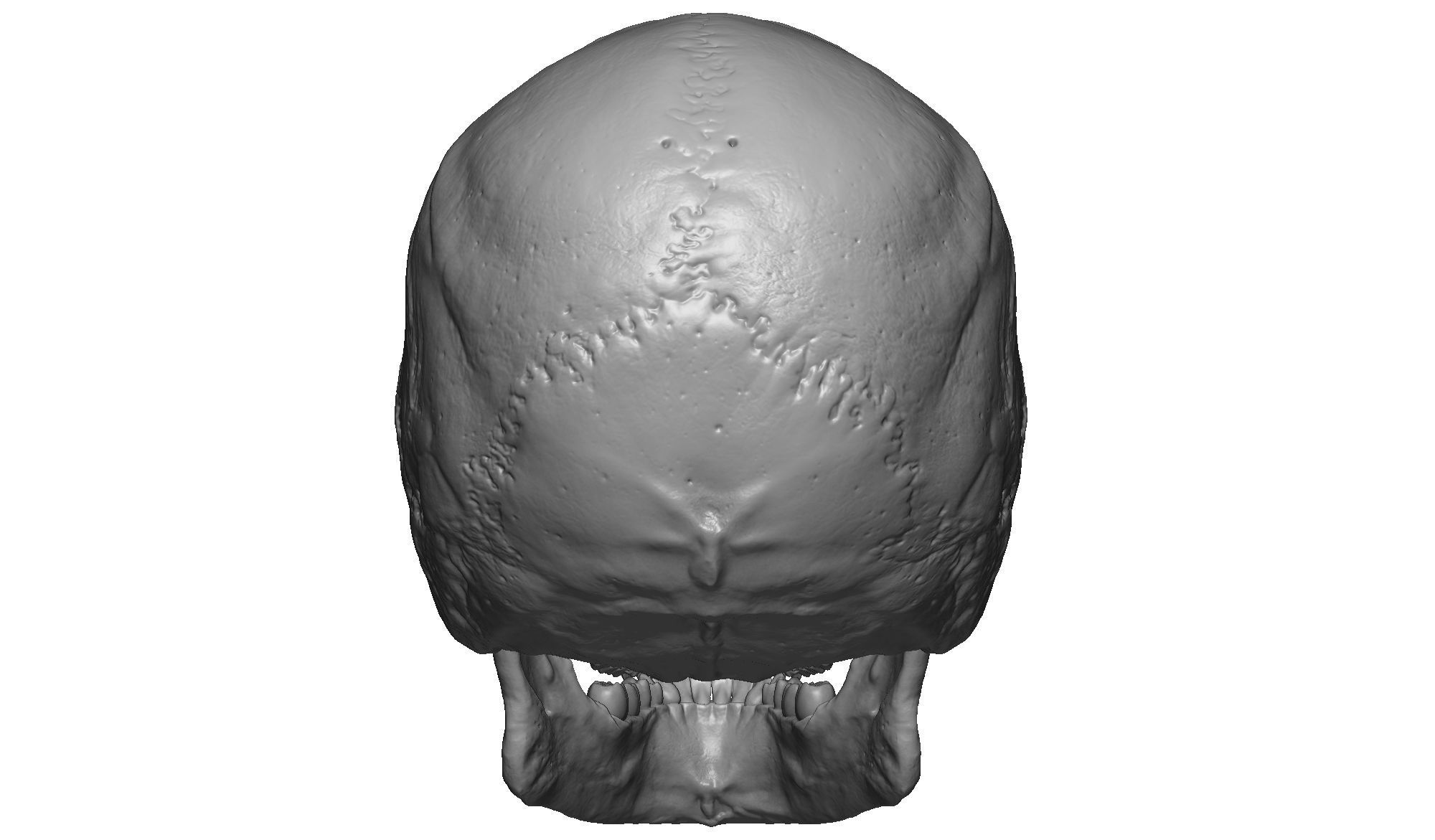 Female human skull- realistic 3d print model- 3 versions set 3D print model_8