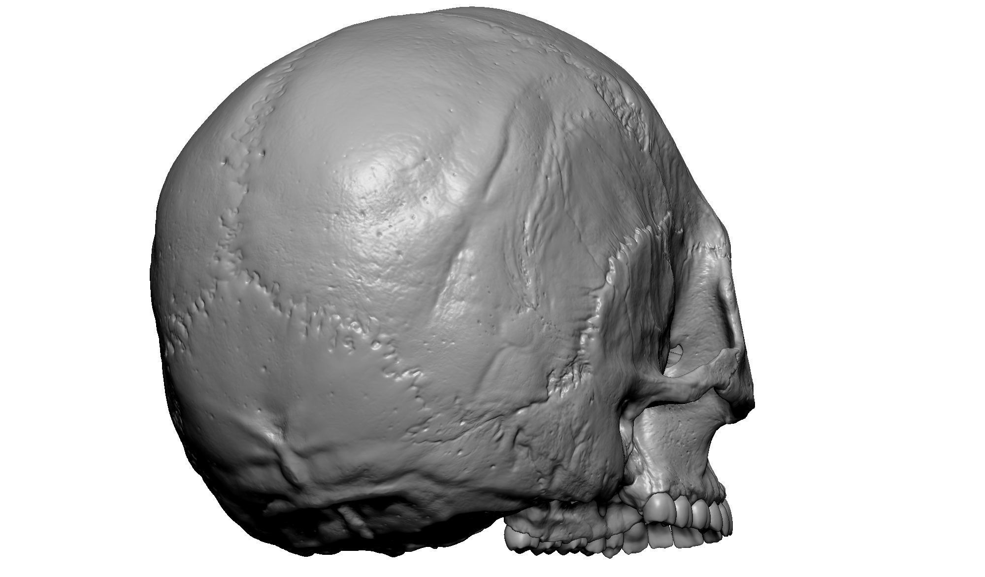Female human skull- realistic 3d print model- 3 versions set 3D print model_4