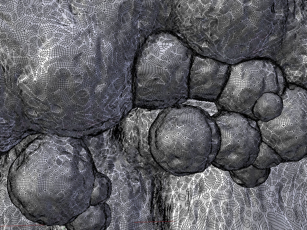 Artery hardening plaques 3D model_2