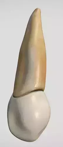 Maxillary Canine