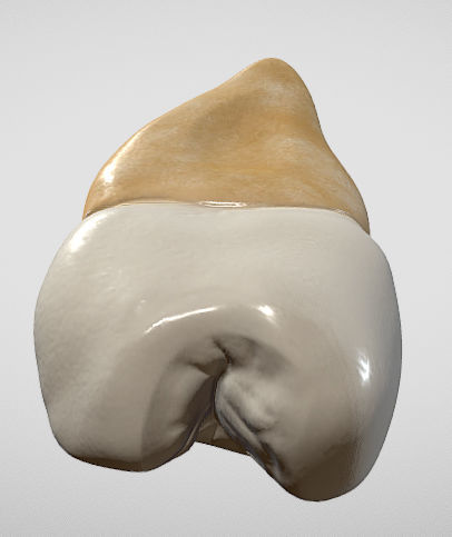 Maxillary Second Premolar Low-poly 3D model_6